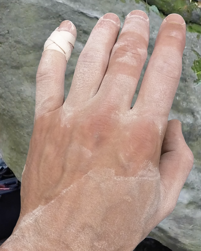 Hand with no glue redidue after using eXoTendon tape.